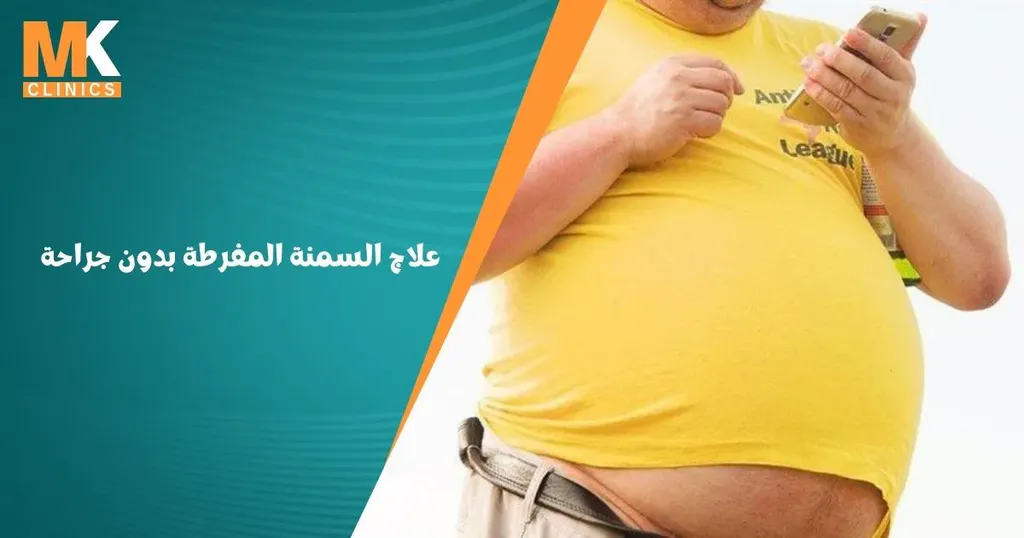 علاج السمنة المفرطة بدون جراحة: التخلص من السمنة نهائياً 3 علاج السمنة المفرطة بدون جراحة
