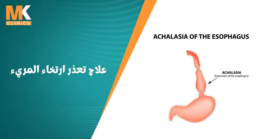 علاج تعذر ارتخاء المريء