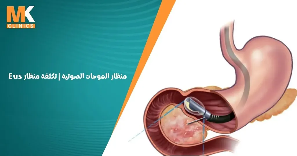 منظار الموجات الصوتية ما هي تكلفة منظار Eus ؟