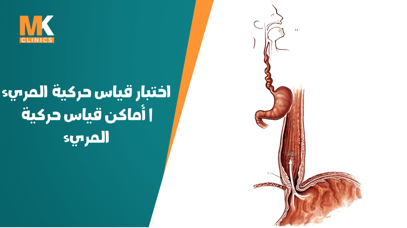 قياس حركية المريء
