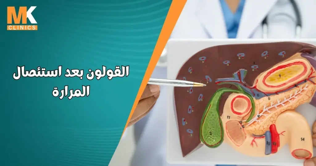 القولون بعد استئصال المرارة