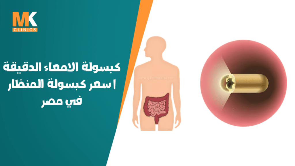كبسولة الامعاء الدقيقة