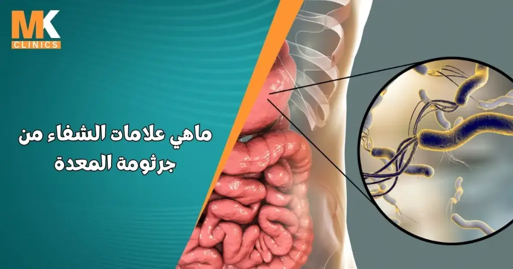 ماهي علامات الشفاء من جرثومة المعدة 10 ماهي علامات الشفاء من جرثومة المعدة
