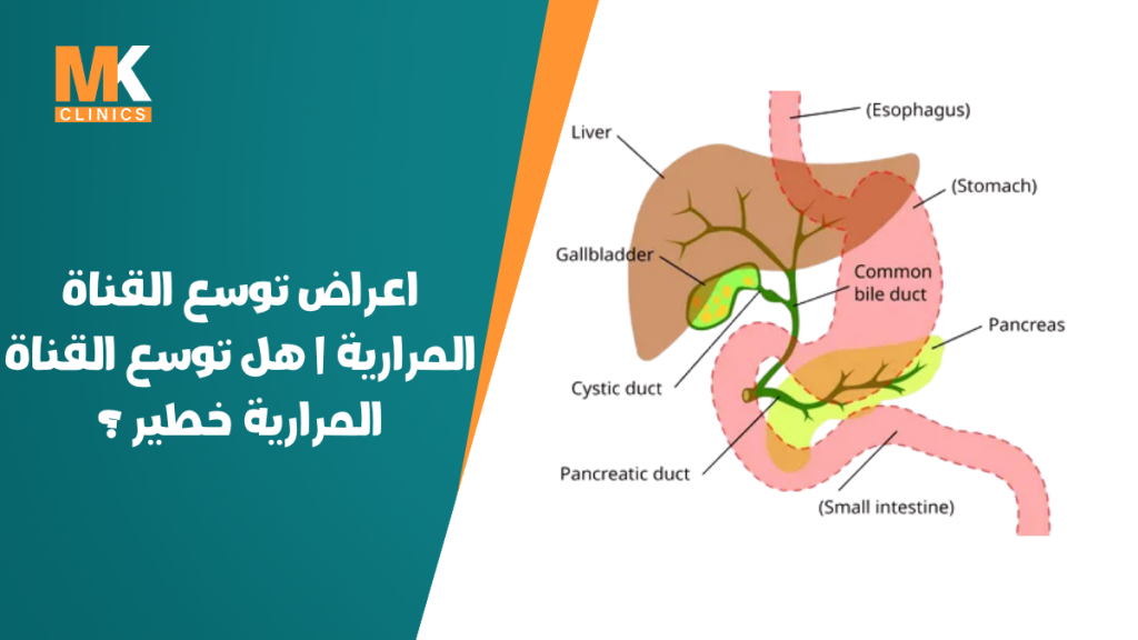 اعراض توسع القناة المرارية