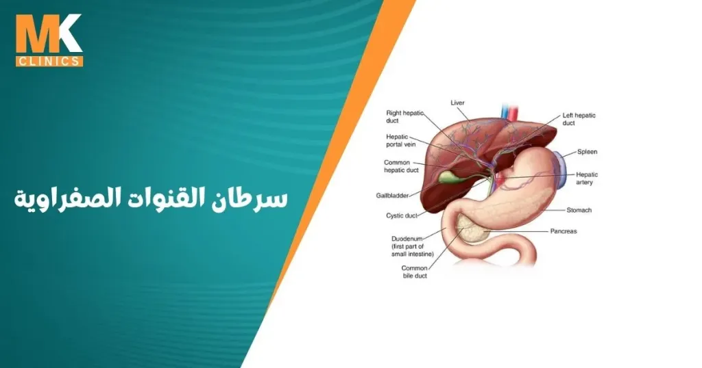 سرطان القنوات الصفراوية
