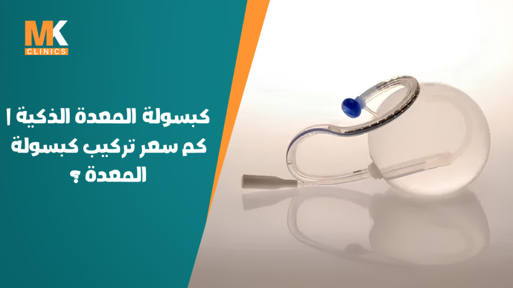 كبسولة المعدة الذكية