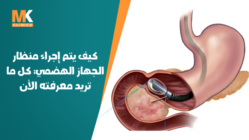 منظار الجهاز الهضمي