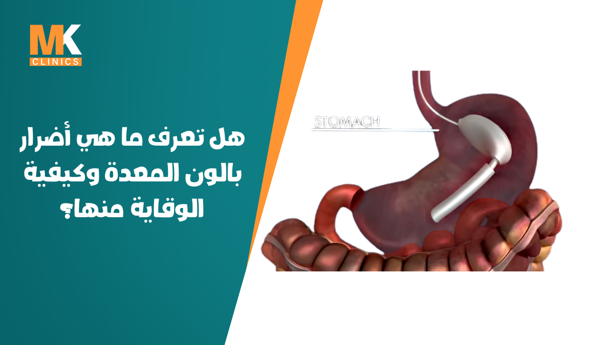 أضرار بالون المعدة
