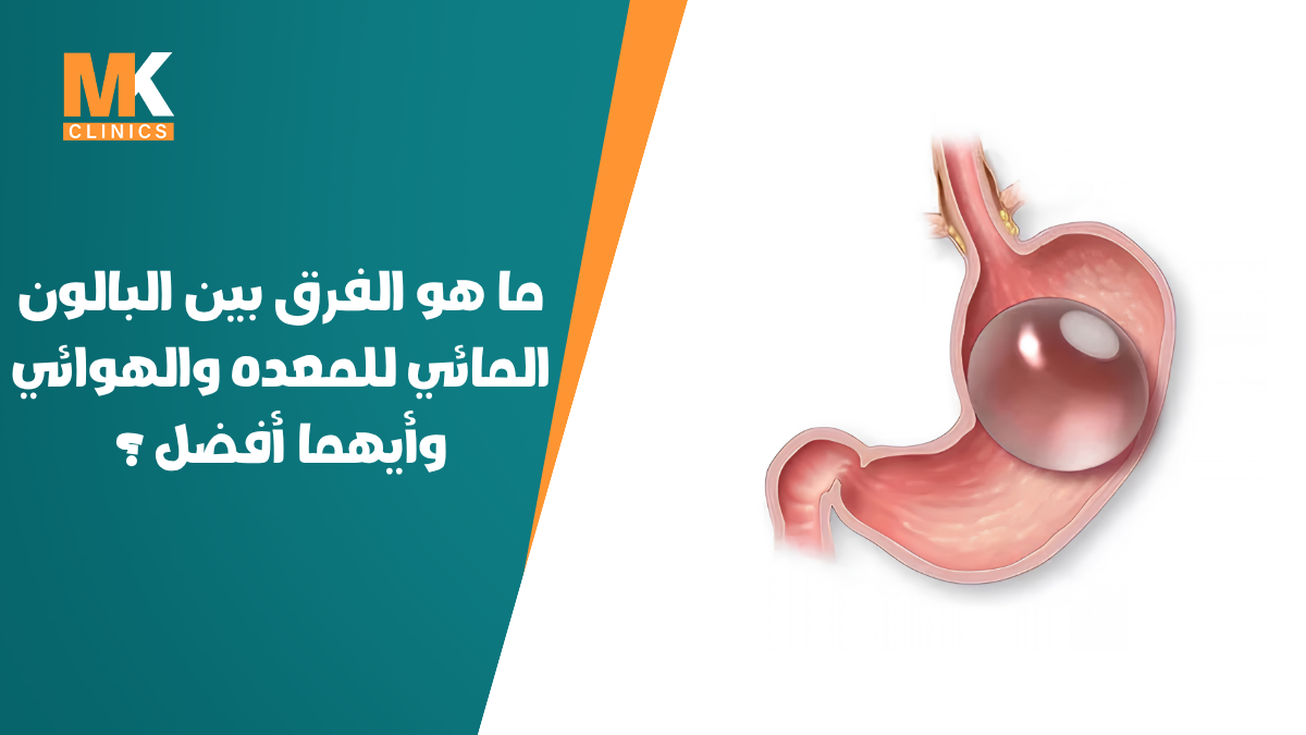 البالون المائي للمعده