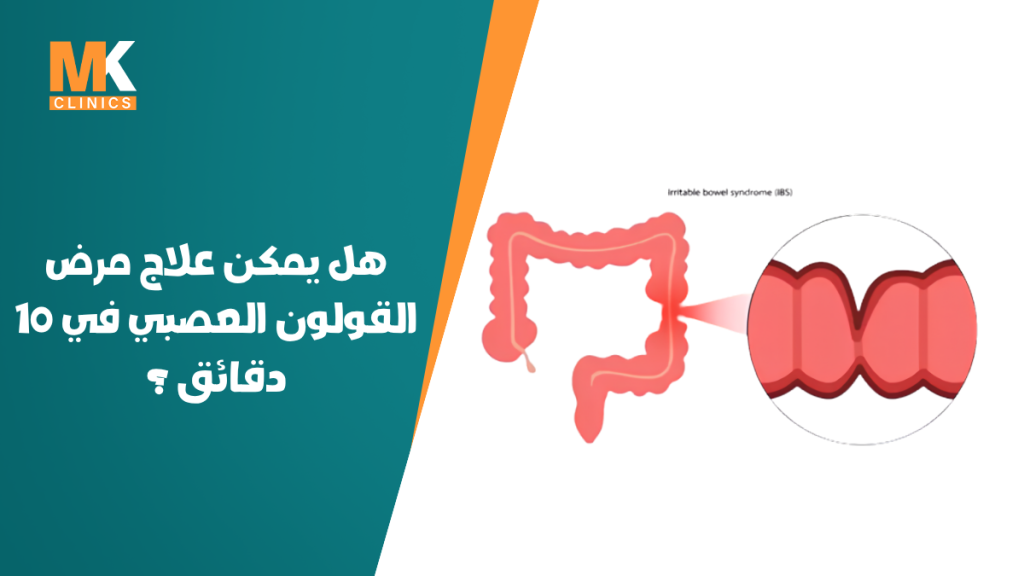 علاج مرض القولون العصبي في 10 دقائق