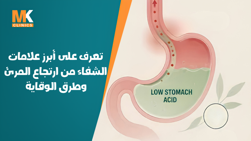 علامات الشفاء من ارتجاع المرئ