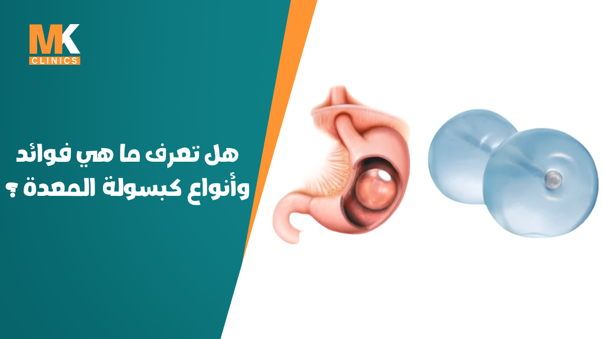 كبسولة المعدة