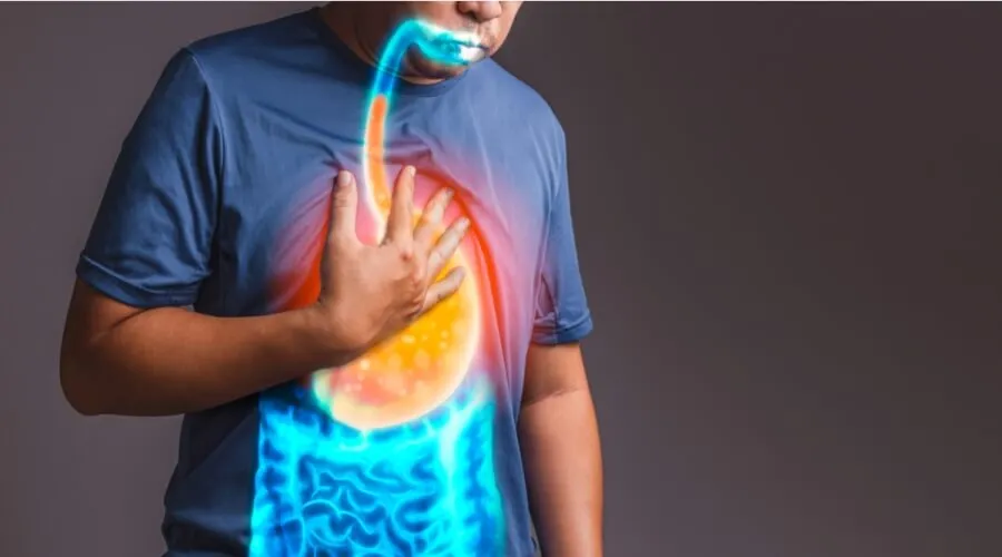 اكتشف الآن أعراض ارتجاع المرئ الشديد وطرق الوقاية المناسبة 3 أفضل طرق علاج ارتجاع المريء نهائيا