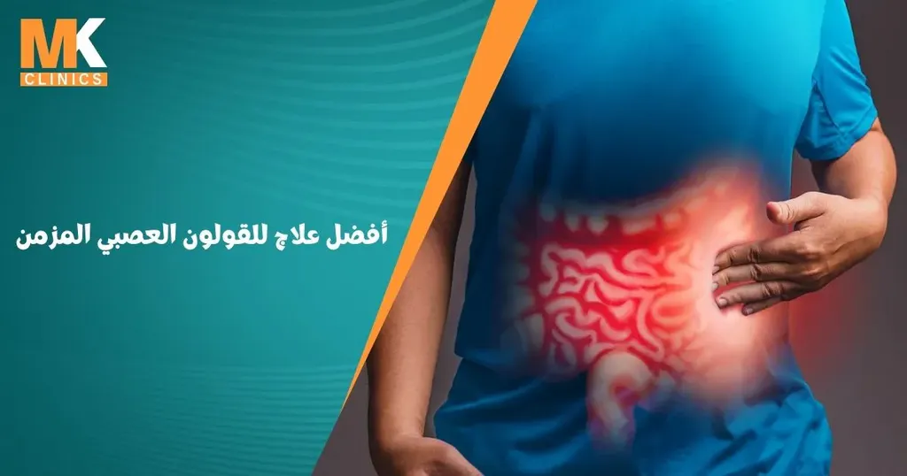 أفضل علاج للقولون العصبي المزمن