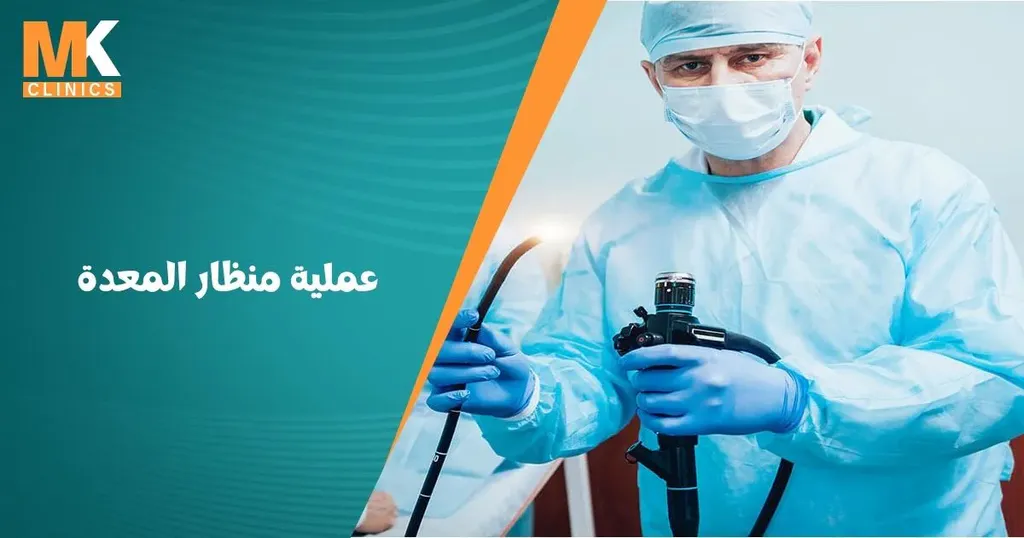 عملية منظار المعدة