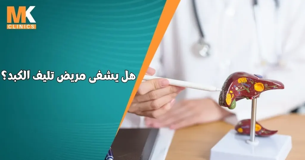 هل يشفى مريض تليف الكبد