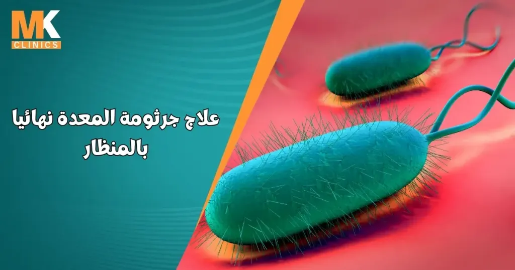 علاج جرثومة المعدة نهائيا بالمنظار