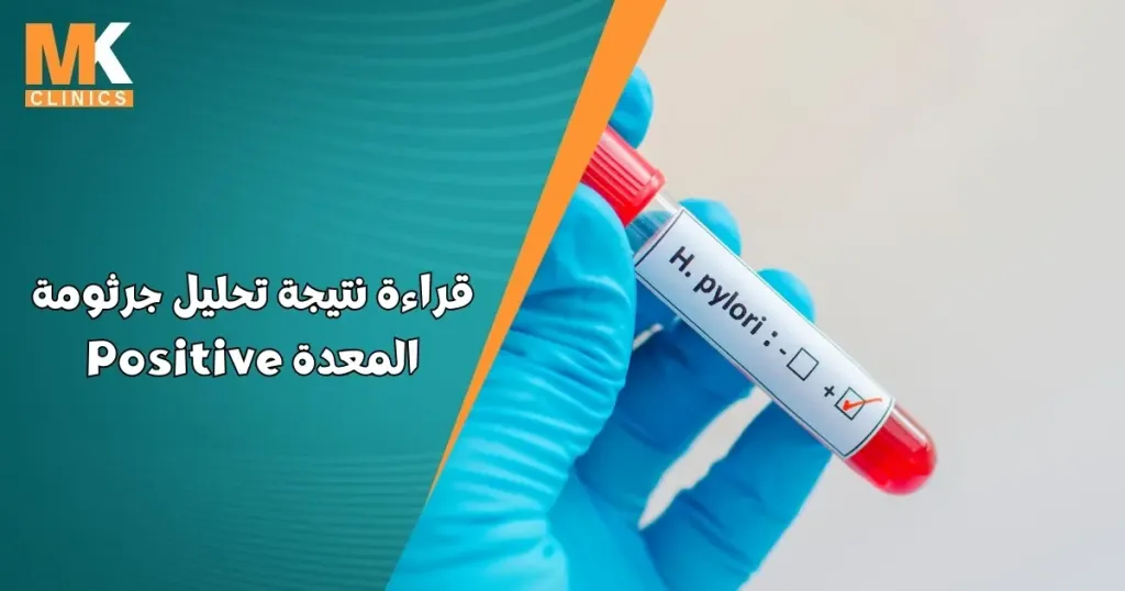 قراءة نتيجة تحليل جرثومة المعدة Positive