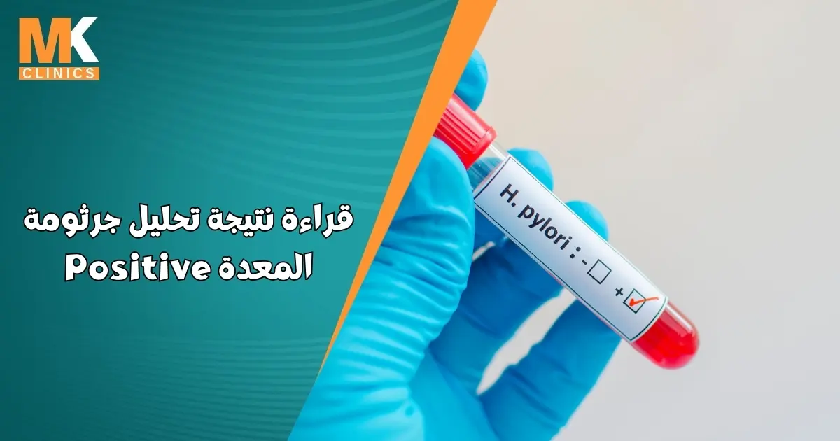 قراءة نتيجة تحليل جرثومة المعدة Positive