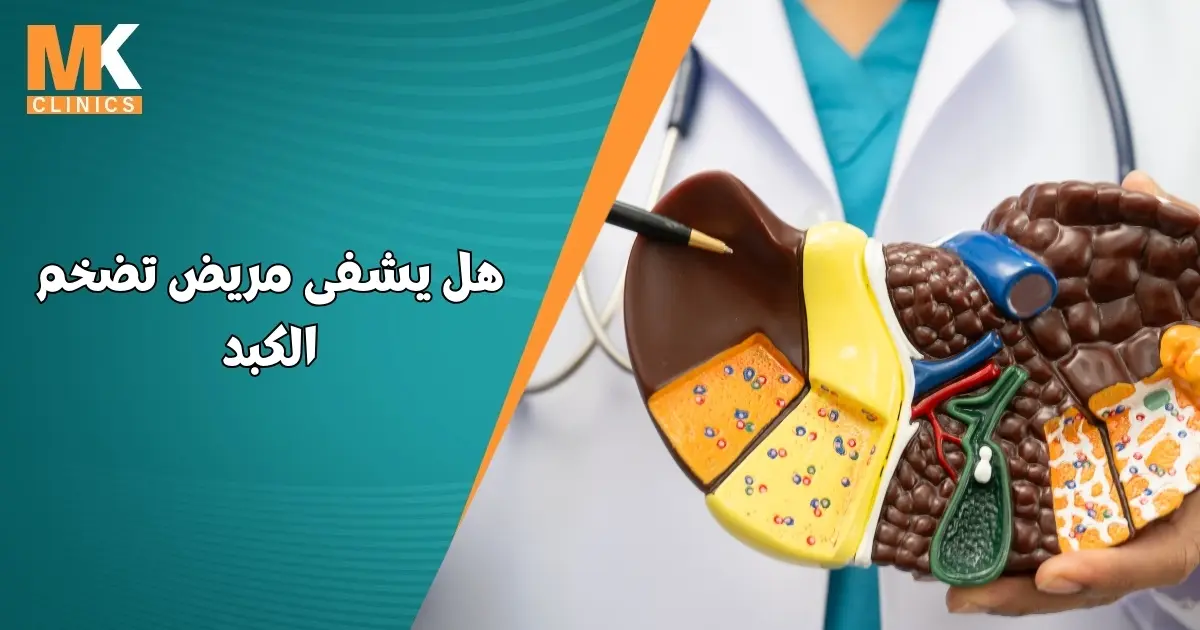 هل يشفى مريض تضخم الكبد
