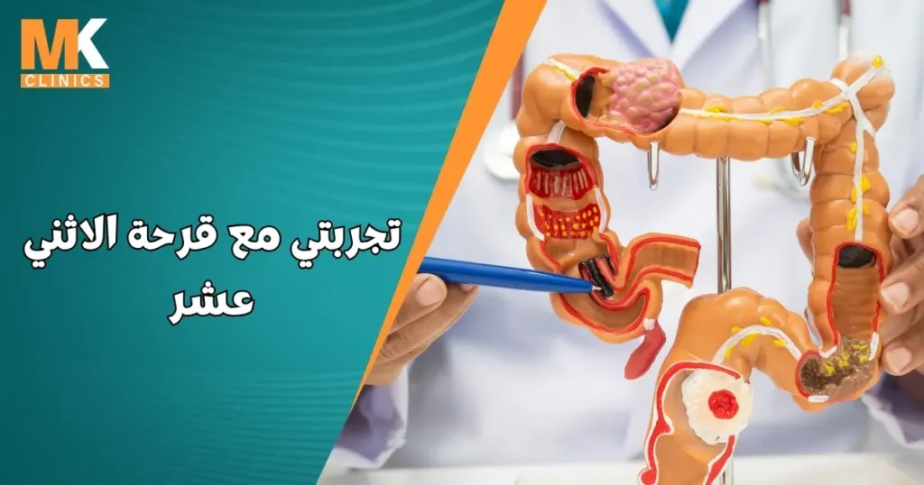 تعرف على تجربتي مع قرحة الاثني عشر وكيف شفيت منها 1 تجربتي مع قرحة الاثني عشر
