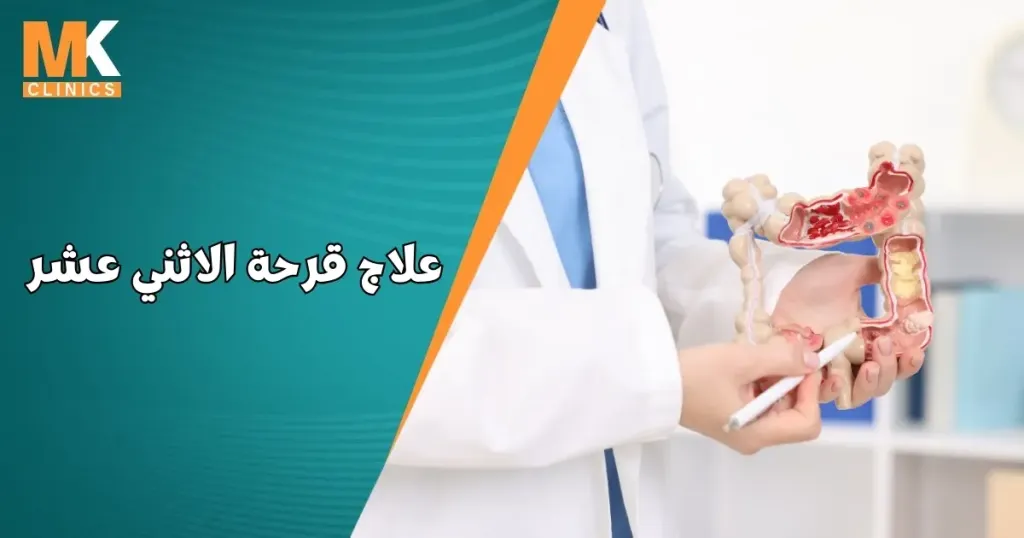 علاج قرحة الاثني عشر