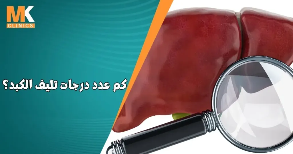 تعرف على درجات تليف الكبد وأعراضه 11 درجات تليف الكبد