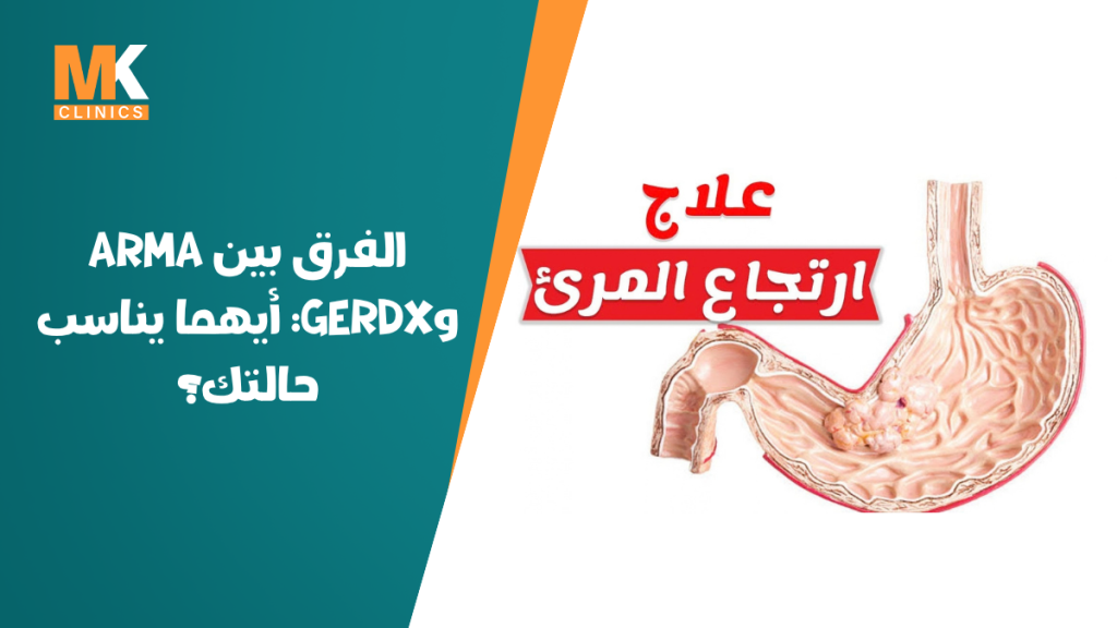 الفرق بين ARMA وGERDx: أيهما يناسب حالتك؟ 9 ARMA مقابل GERDx