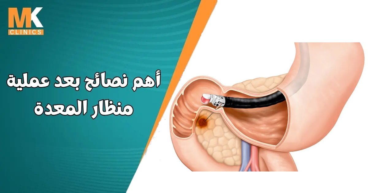 تكلفة منظار EUS في مصر
