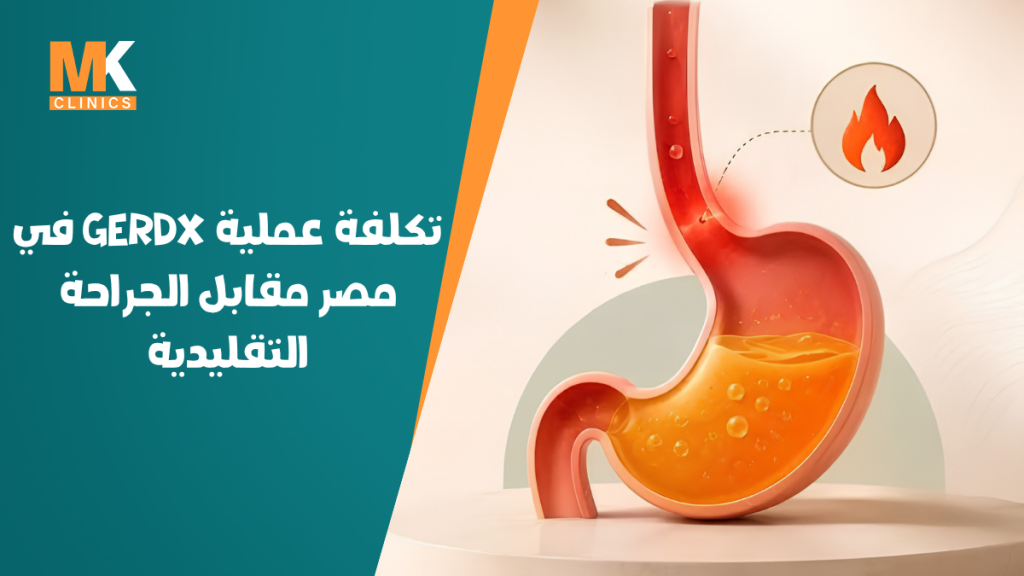 تكلفة عملية GERDx في مصر مقابل الجراحة التقليدية 6 سعر عملية gerdx