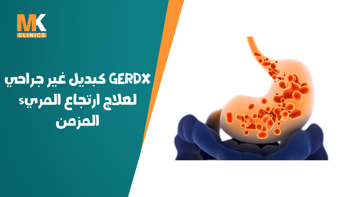 علاج ارتجاع المريء