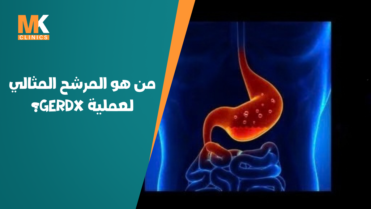 علامات الشفاء من ارتجاع المريء