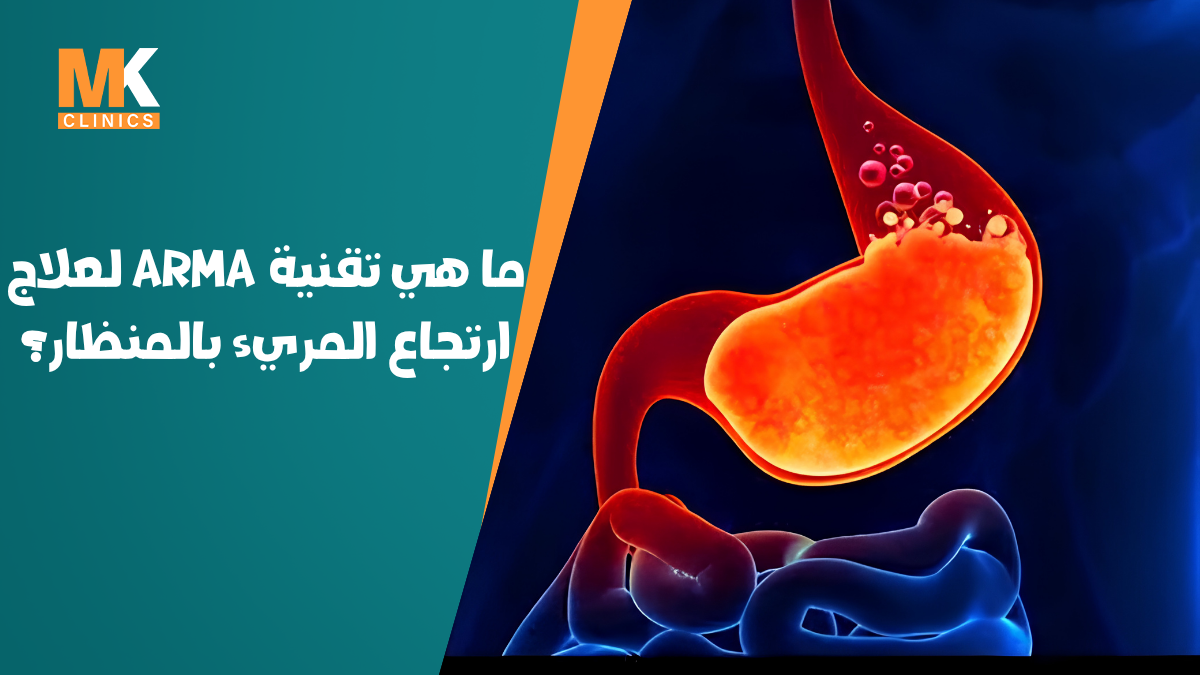 عملية ARMA