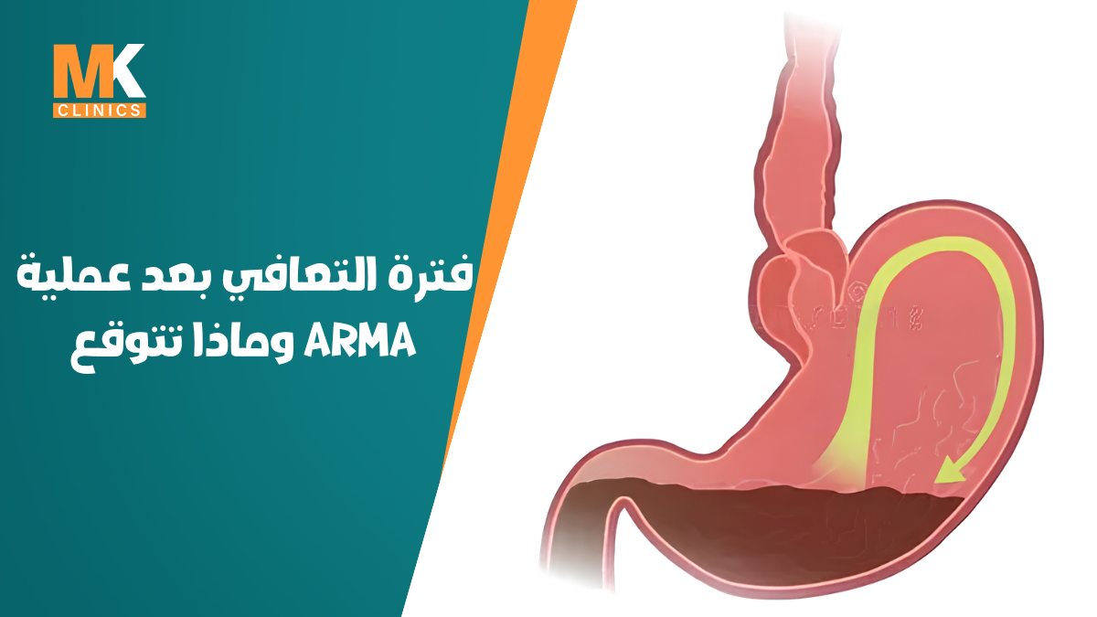 علامات الشفاء من ارتجاع المريء