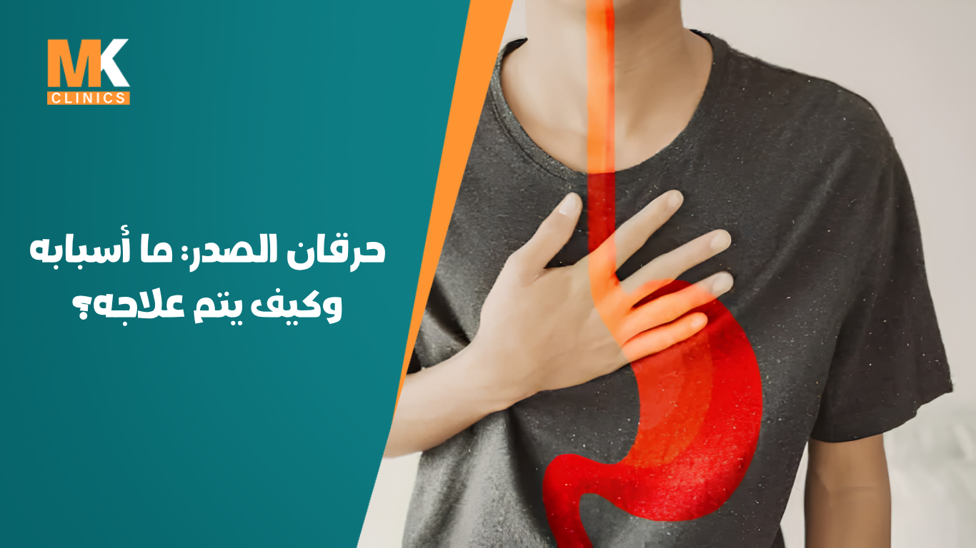 حرقان الصدر