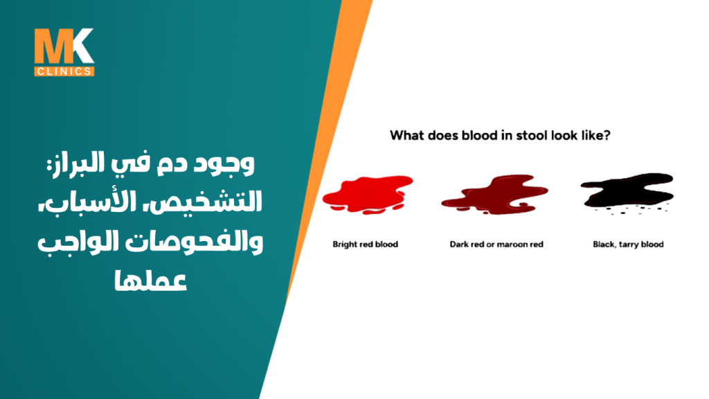 دم في البراز