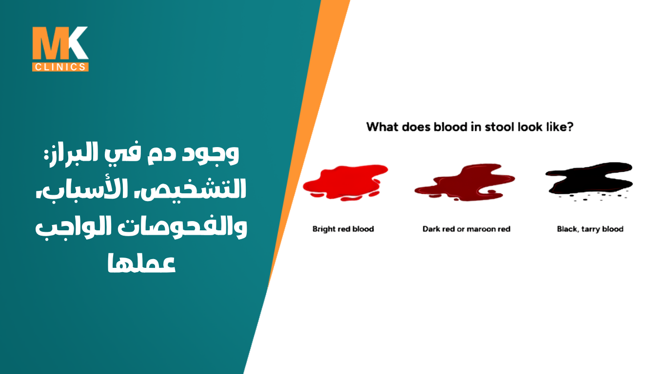 دكتور محمد كريم عاشور 2 دم في البراز